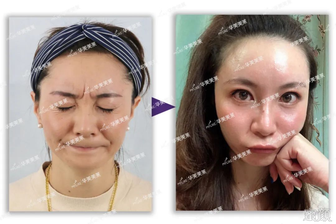 https://img.yiyiaimei.com/mnt/timg/200427/1441462048-7.jpg