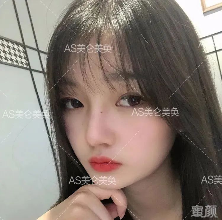 案例图片