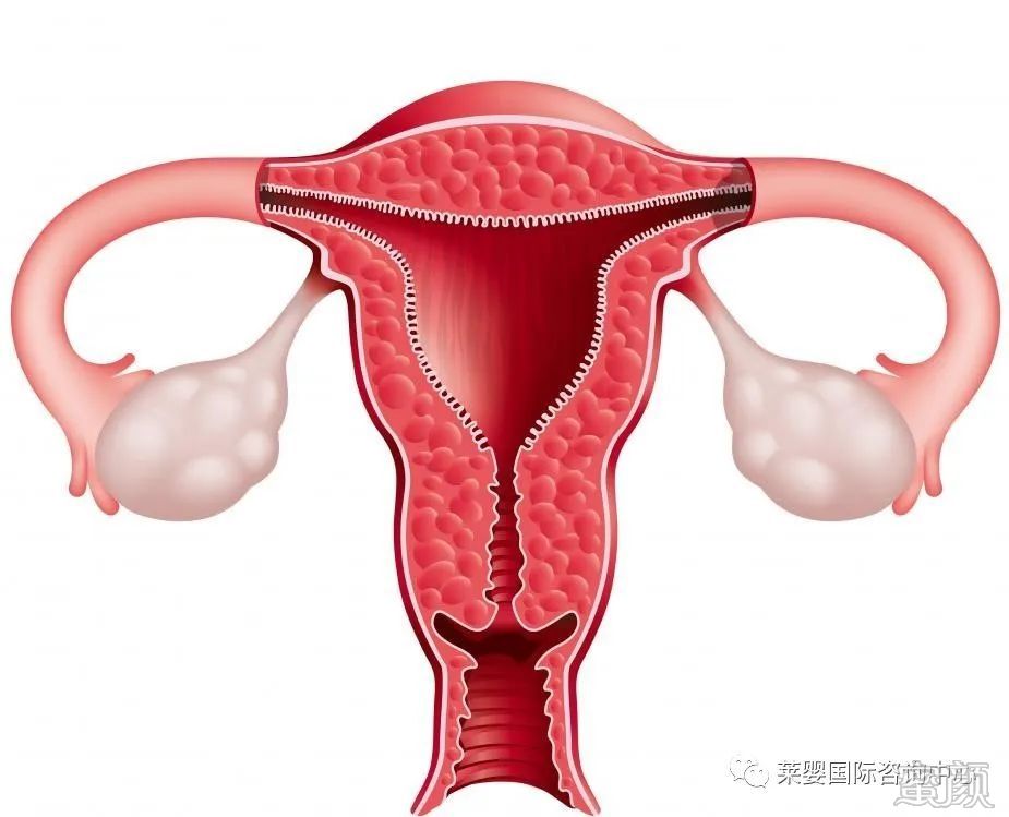 https://img.yiyiaimei.com/mnt/timg/200427/1505524637-1.jpg 案例图片