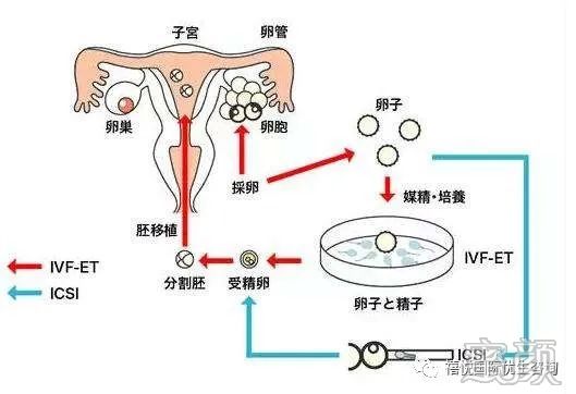 案例图片