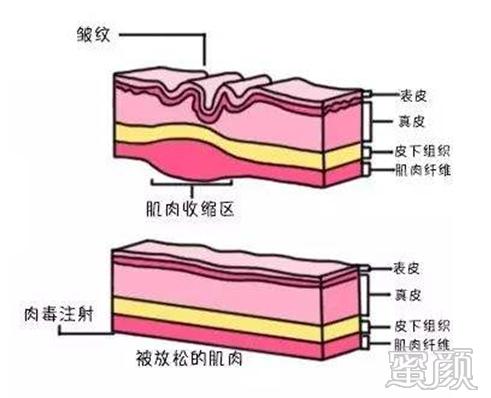 案例图片