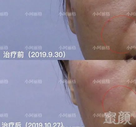 案例图片