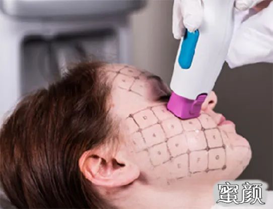 https://img.yiyiaimei.com/mnt/timg/200428/12305263B-3.jpg 案例图片