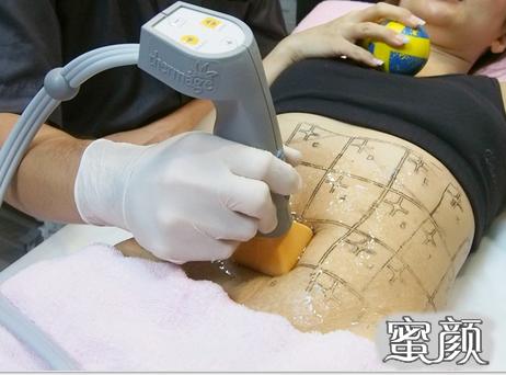 https://img.yiyiaimei.com/mnt/timg/200428/1230555348-5.jpg 案例图片