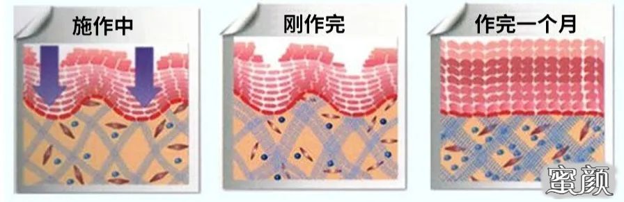 案例图片