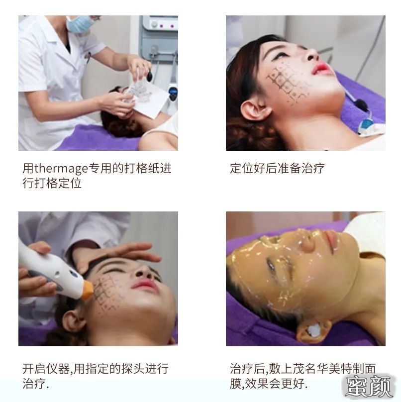 案例图片