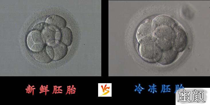 https://img.yiyiaimei.com/mnt/timg/200428/13501Q550-5.jpg 案例图片