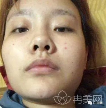 https://img.yiyiaimei.com/mnt/timg/200428/143S32261-0.jpg