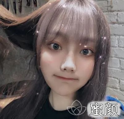 https://img.yiyiaimei.com/mnt/timg/200428/143S612Y-4.jpg