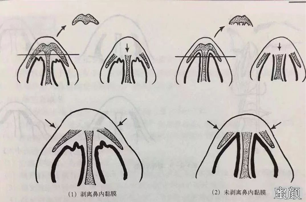 案例图片