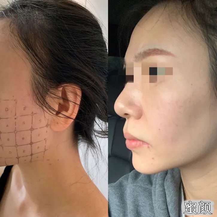 案例图片