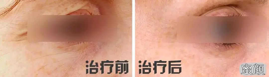 https://img.yiyiaimei.com/mnt/timg/200429/143232L15-9.jpg 案例图片