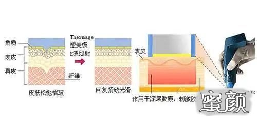 https://img.yiyiaimei.com/mnt/timg/200429/14323V122-13.jpg 案例图片