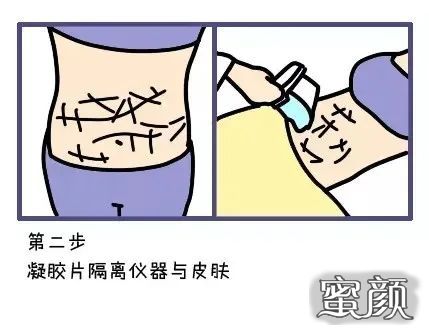 案例图片