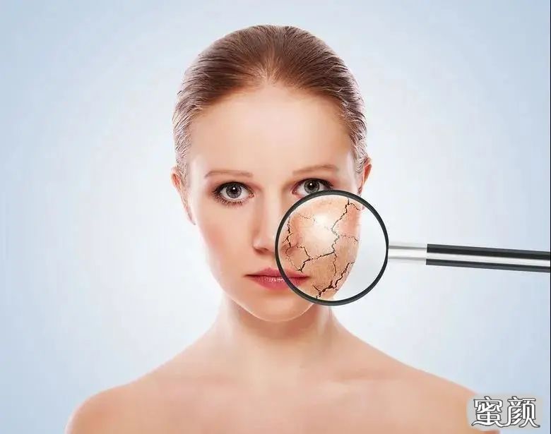 https://img.yiyiaimei.com/mnt/timg/200429/1445116006-0.jpg 案例图片