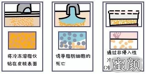 案例图片