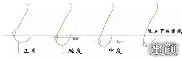 案例图片