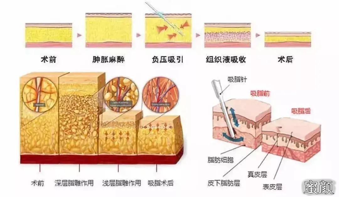 案例图片