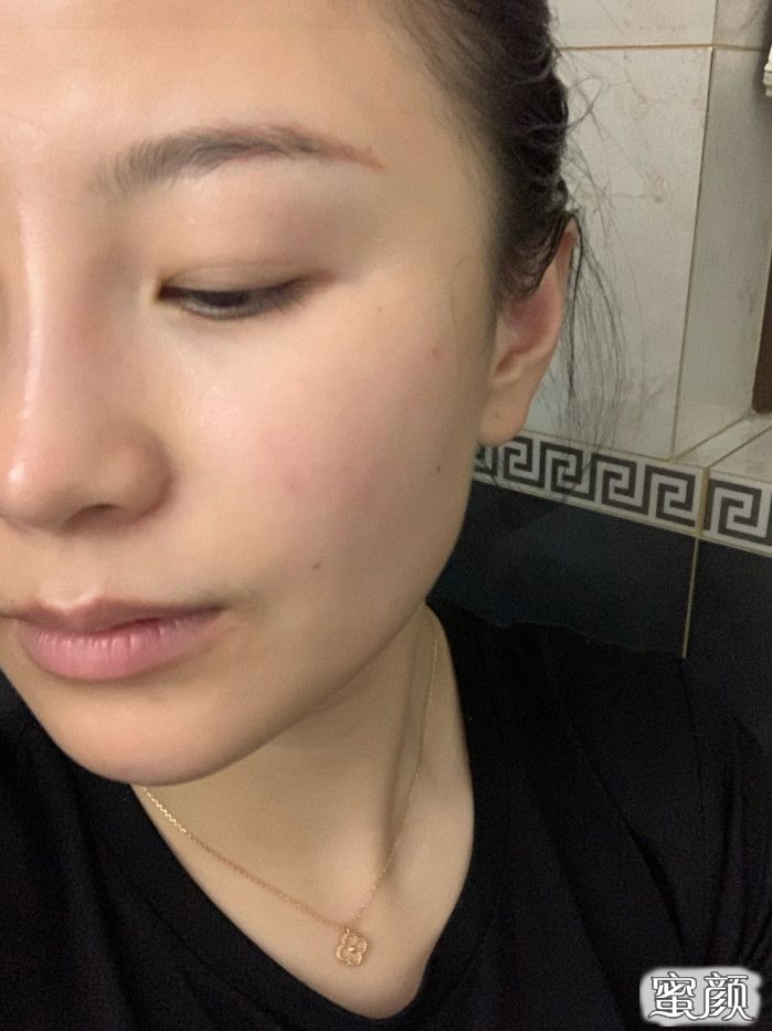 案例图片