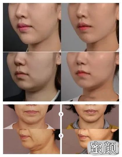 https://img.yiyiaimei.com/mnt/timg/200430/1413352441-2.jpg