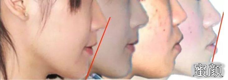 https://img.yiyiaimei.com/mnt/timg/200501/132A35548-12.jpg