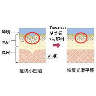 案例图片