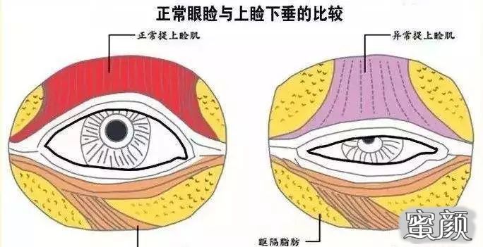 案例图片