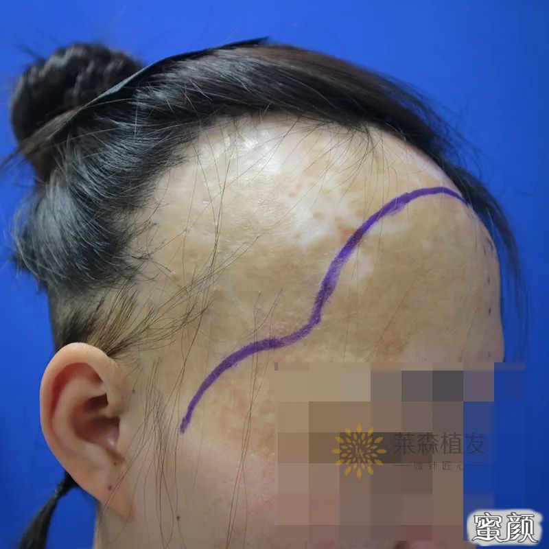 https://img.yiyiaimei.com/mnt/timg/200502/1222343Y5-4.jpg