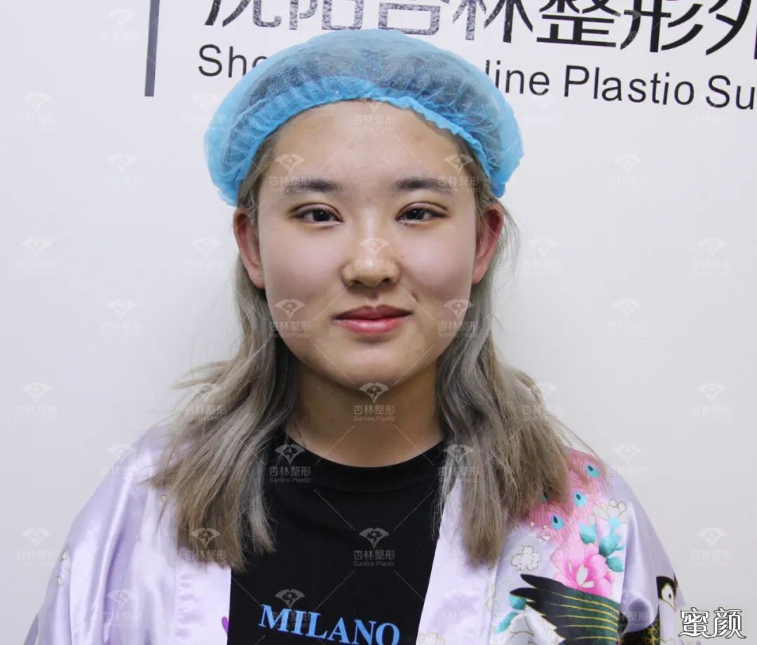 https://img.yiyiaimei.com/mnt/timg/200503/115QAK2-4.jpg 案例图片