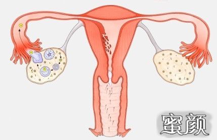 https://img.yiyiaimei.com/mnt/timg/200503/132U9EA-1.jpg 案例图片