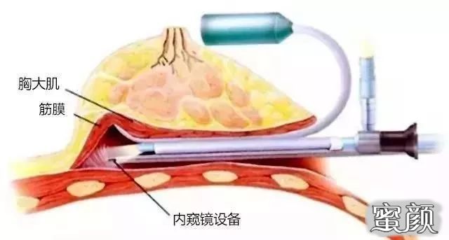 案例图片