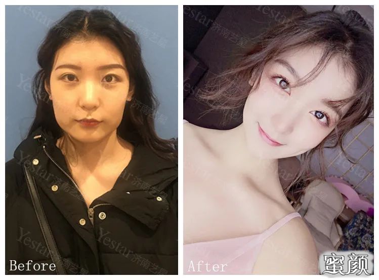 案例图片