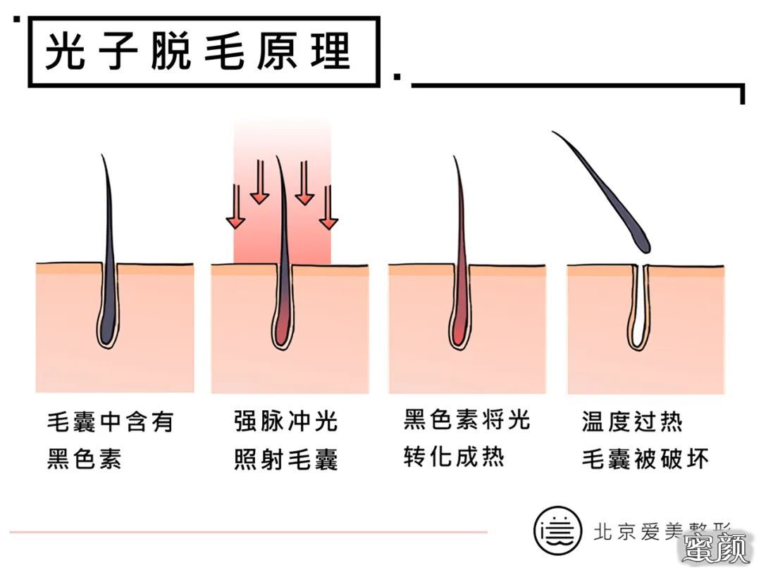 案例图片