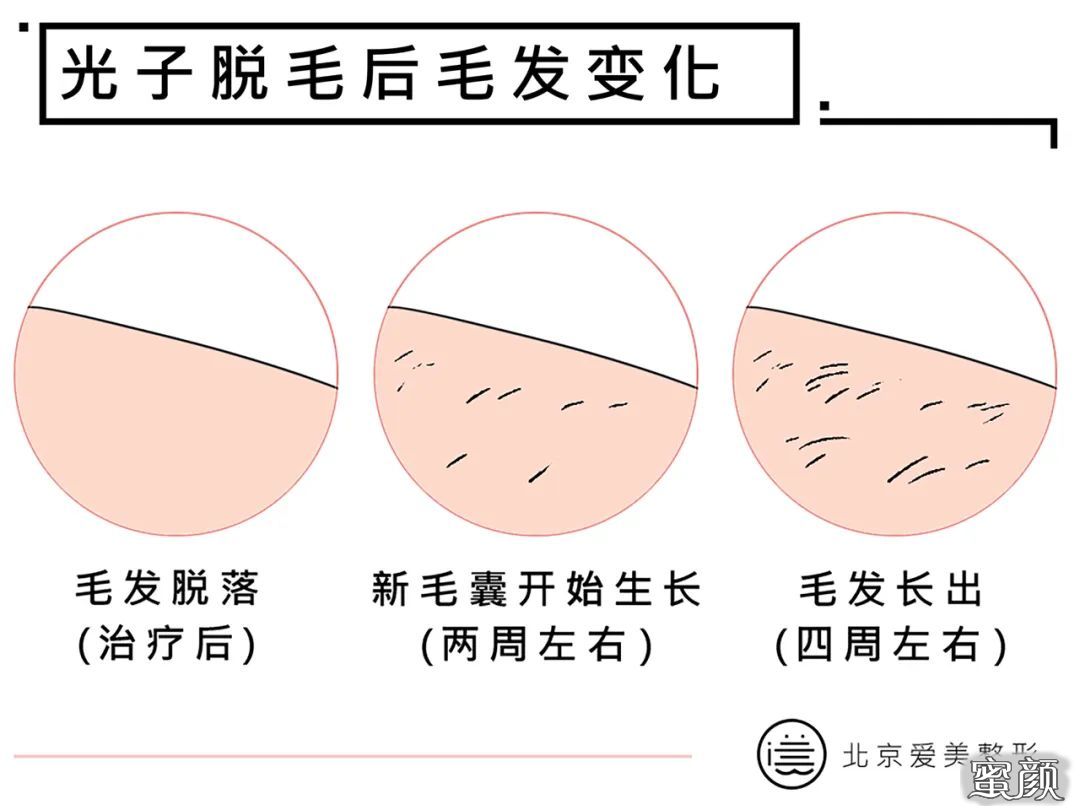 案例图片