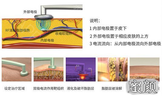 案例图片
