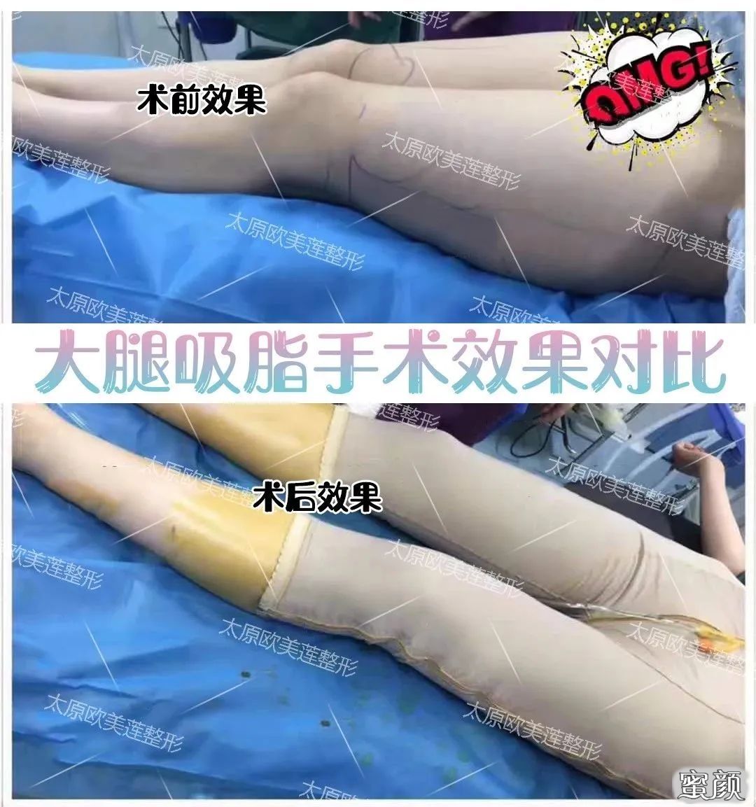 案例图片
