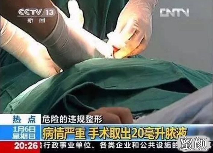 https://img.yiyiaimei.com/mnt/timg/200505/14115214V-6.jpg 案例图片