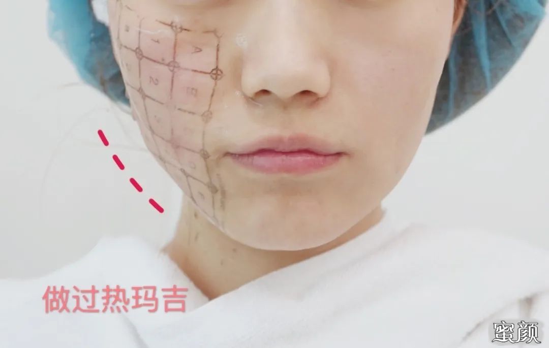 案例图片