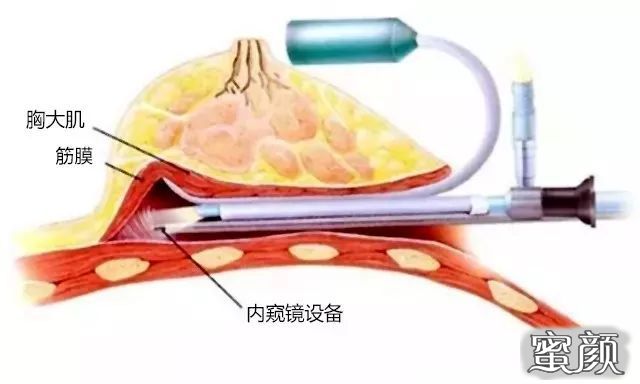 案例图片