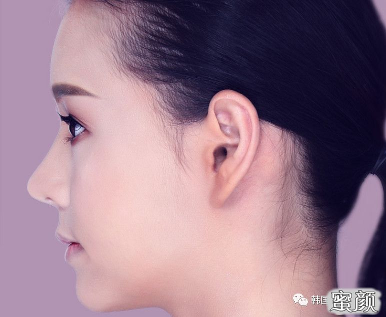 案例图片