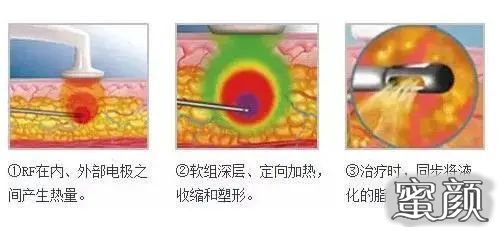 案例图片