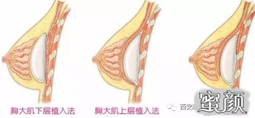 案例图片