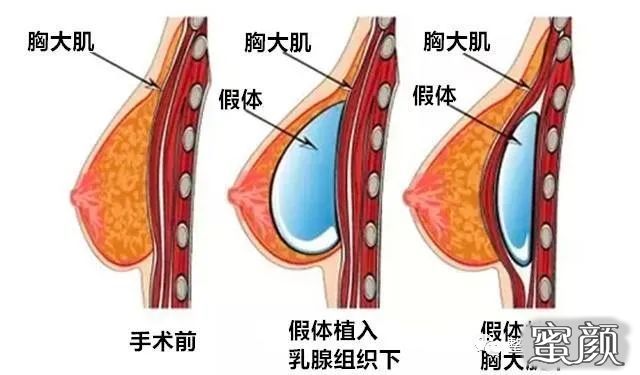 案例图片