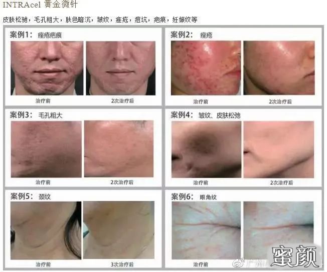 https://img.yiyiaimei.com/mnt/timg/200505/160S91953-4.jpg