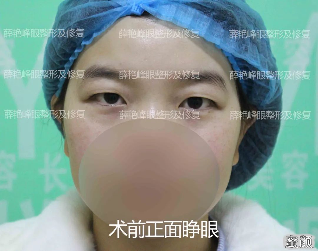 案例图片