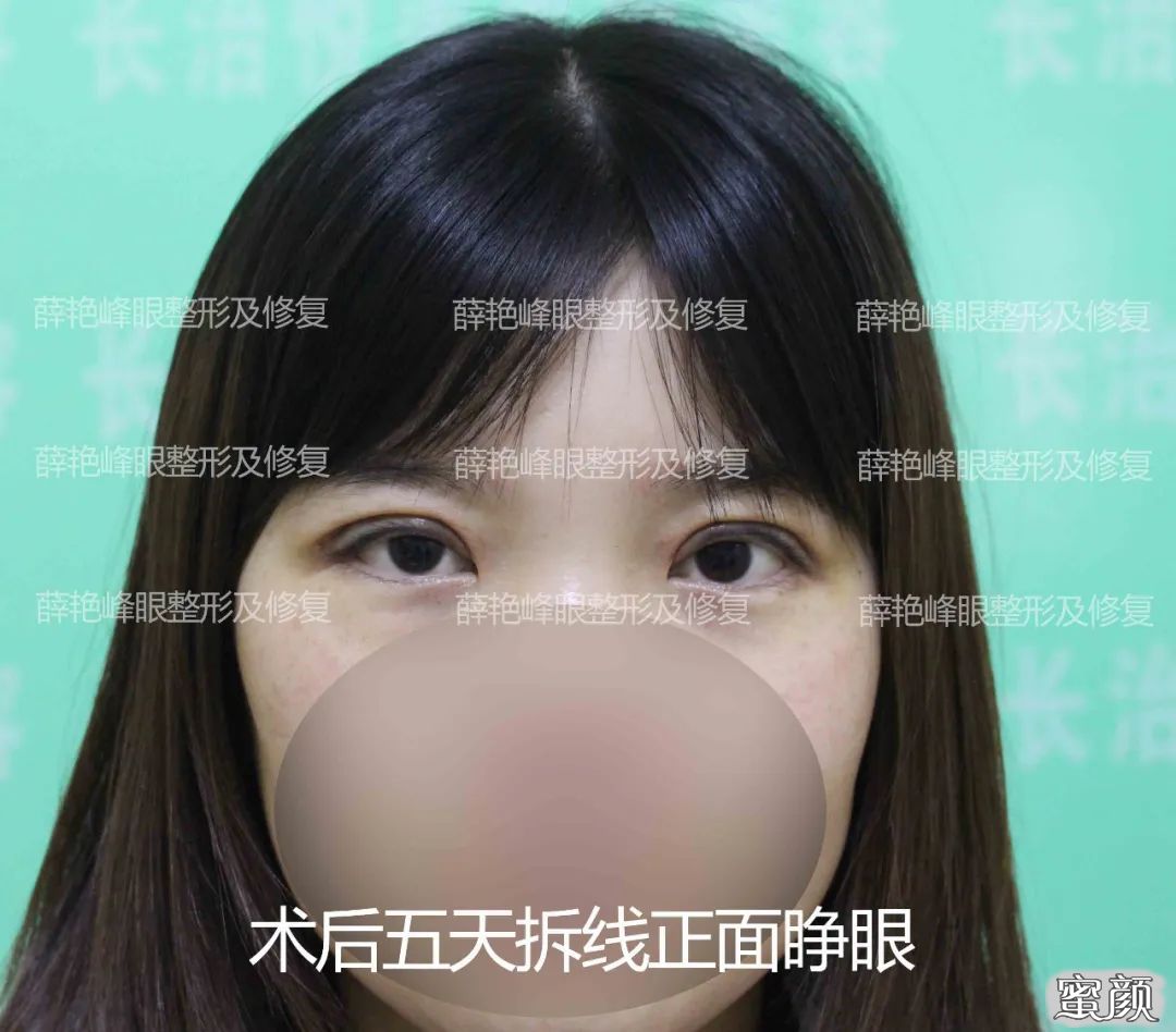 案例图片