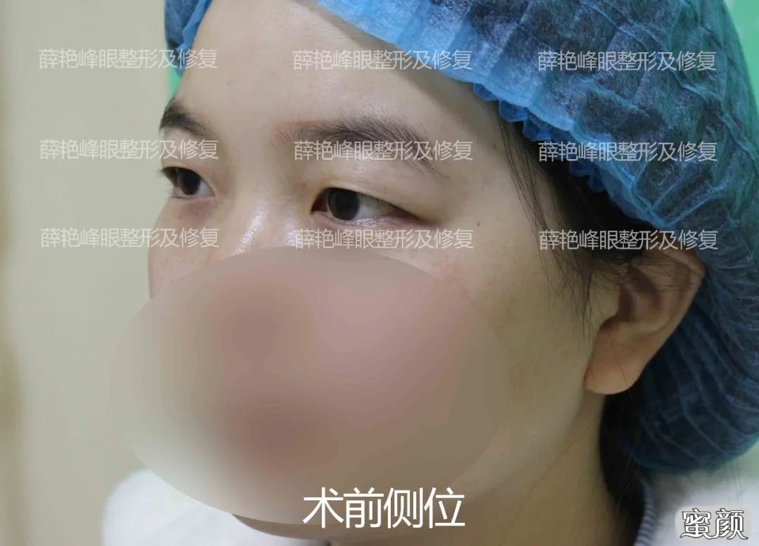 案例图片