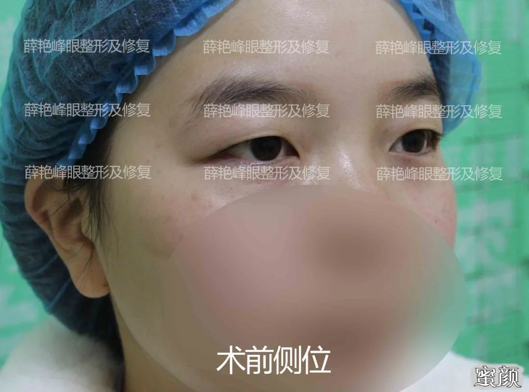 案例图片