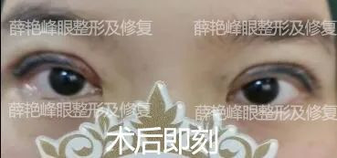 案例图片