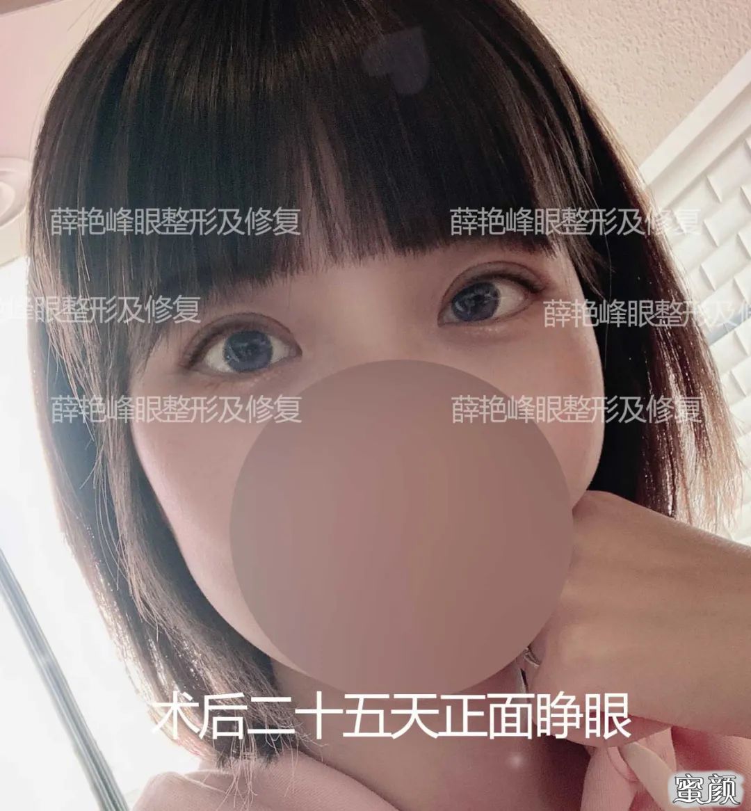 案例图片